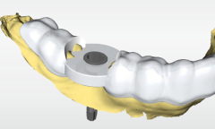 Cerec sw