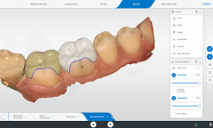 Cerec sw