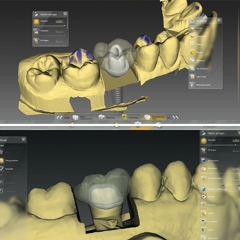 Inlab cad sw 20