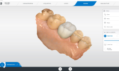 Cerec sw